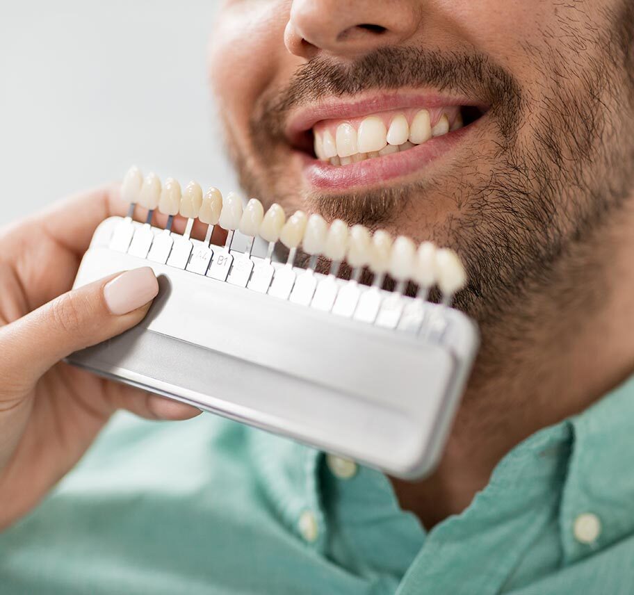 Higienista prueba carillas dentales