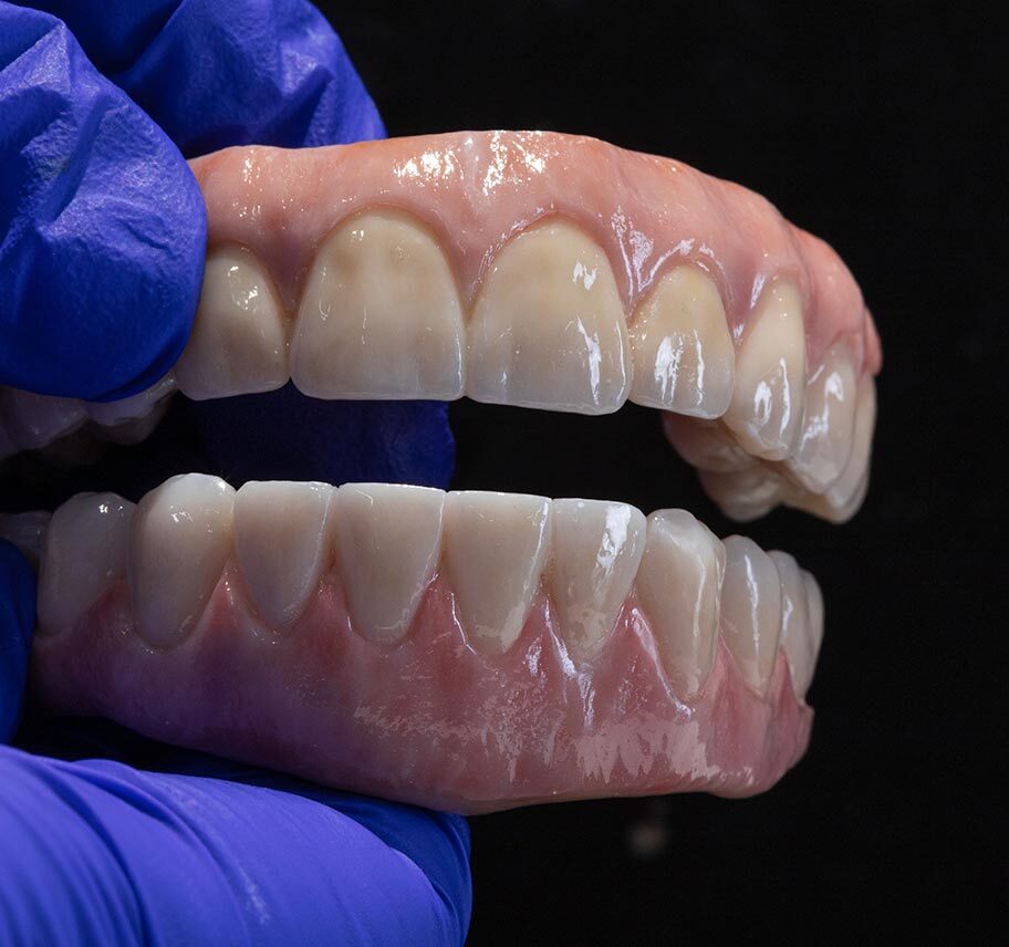 Prótesis dentales en la mano del personal clínico